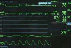 A heart monitor
