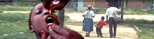 The best treatment for post-polio syndrome is preventive
