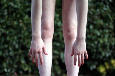ragged limbs