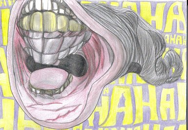 Smile - Cleft  palate laughter