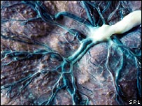 Placenta