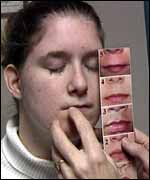 FAS diagnosis
