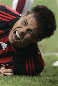 Ronaldo contundido