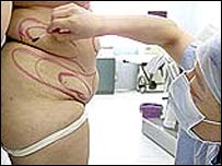 Médico e paciente de cirurgia plástica