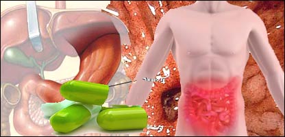 زخم معده