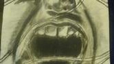 Jonez the mouth...