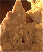 Damaged Liver