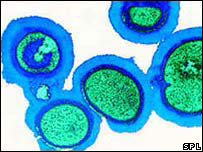 Bactéria MRSA