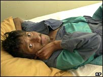 ایڈز